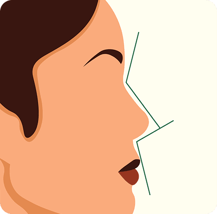 image of Rhinoplasty