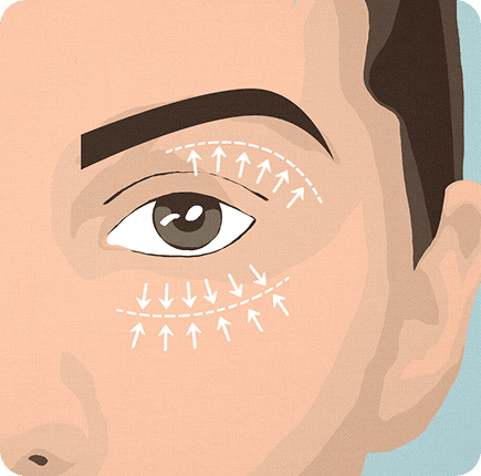 image of Blepharoplasty
