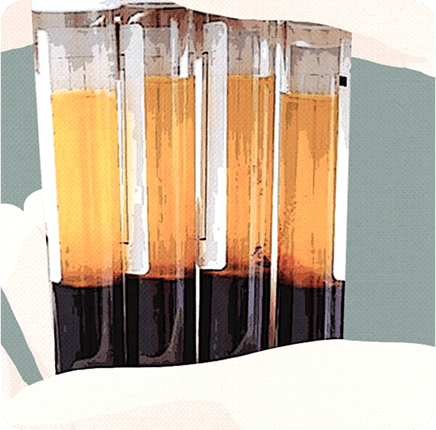 image of Platelet-Rich Plasma