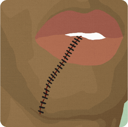 image of Trauma Craniofacial Surgery